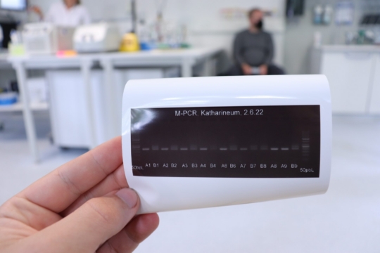 Gelelektrophorese Ergebnisse